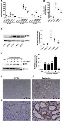 <mark class="highlighted">NLRP</mark>2 Regulates Proinflammatory and Antiapoptotic Responses in Proximal Tubular Epithelial Cells